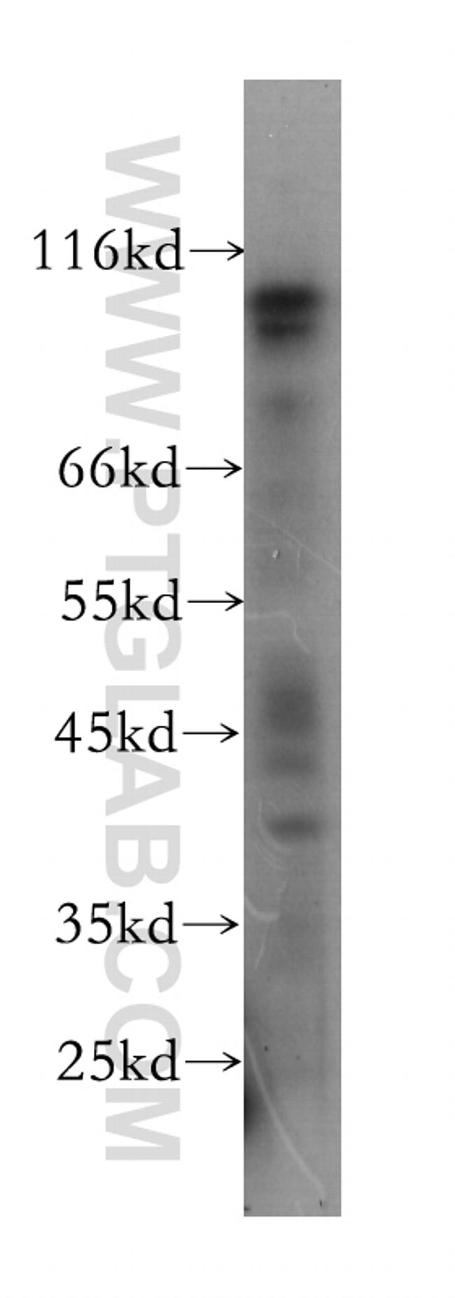 DGCR8 Antibody in Western Blot (WB)