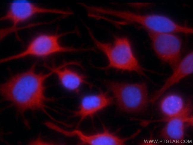 RISC Antibody in Immunocytochemistry (ICC/IF)
