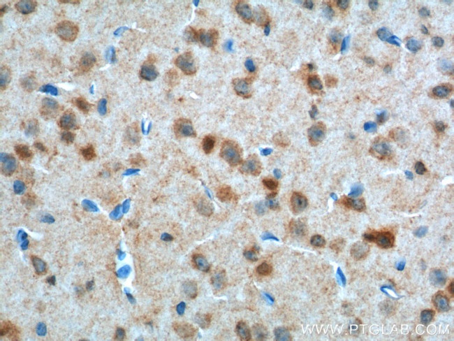 PFN2 Antibody in Immunohistochemistry (Paraffin) (IHC (P))