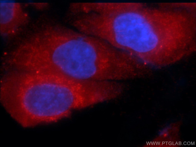 ITM2C Antibody in Immunocytochemistry (ICC/IF)