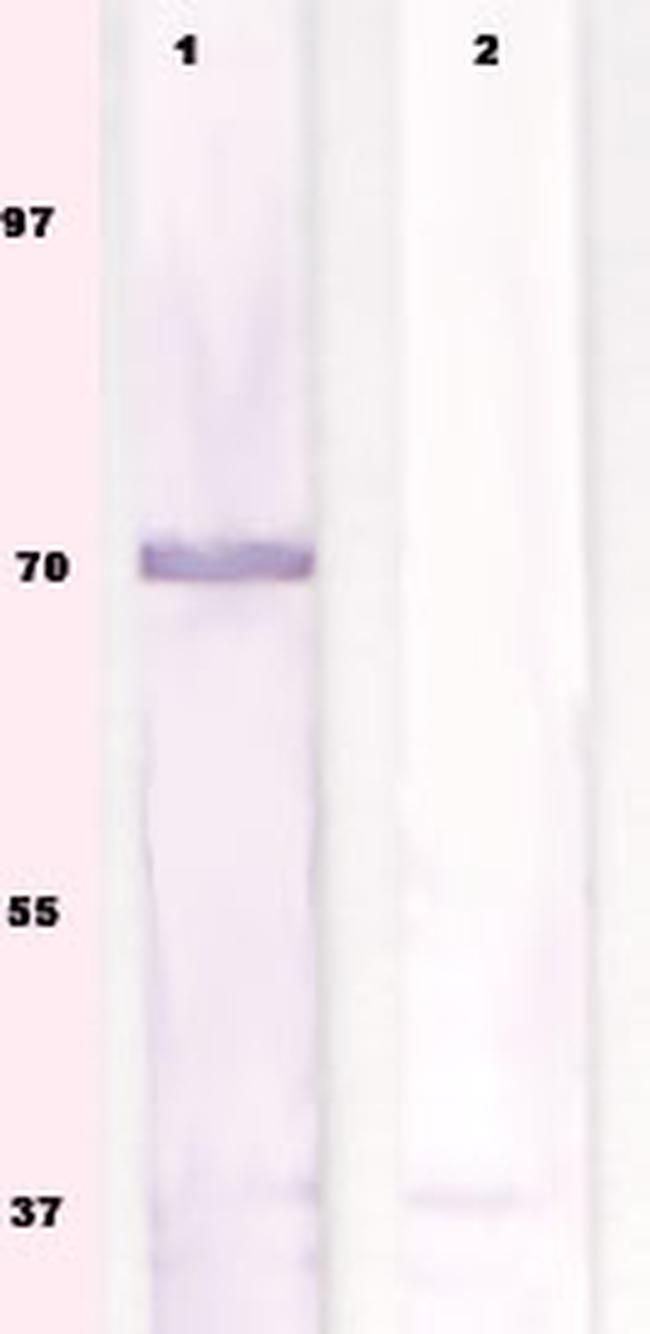 Phospho-S6K (Ser434) Antibody in Western Blot (WB)