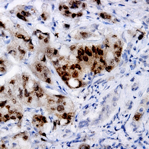 IKK-alpha Antibody in Immunohistochemistry (Paraffin) (IHC (P))