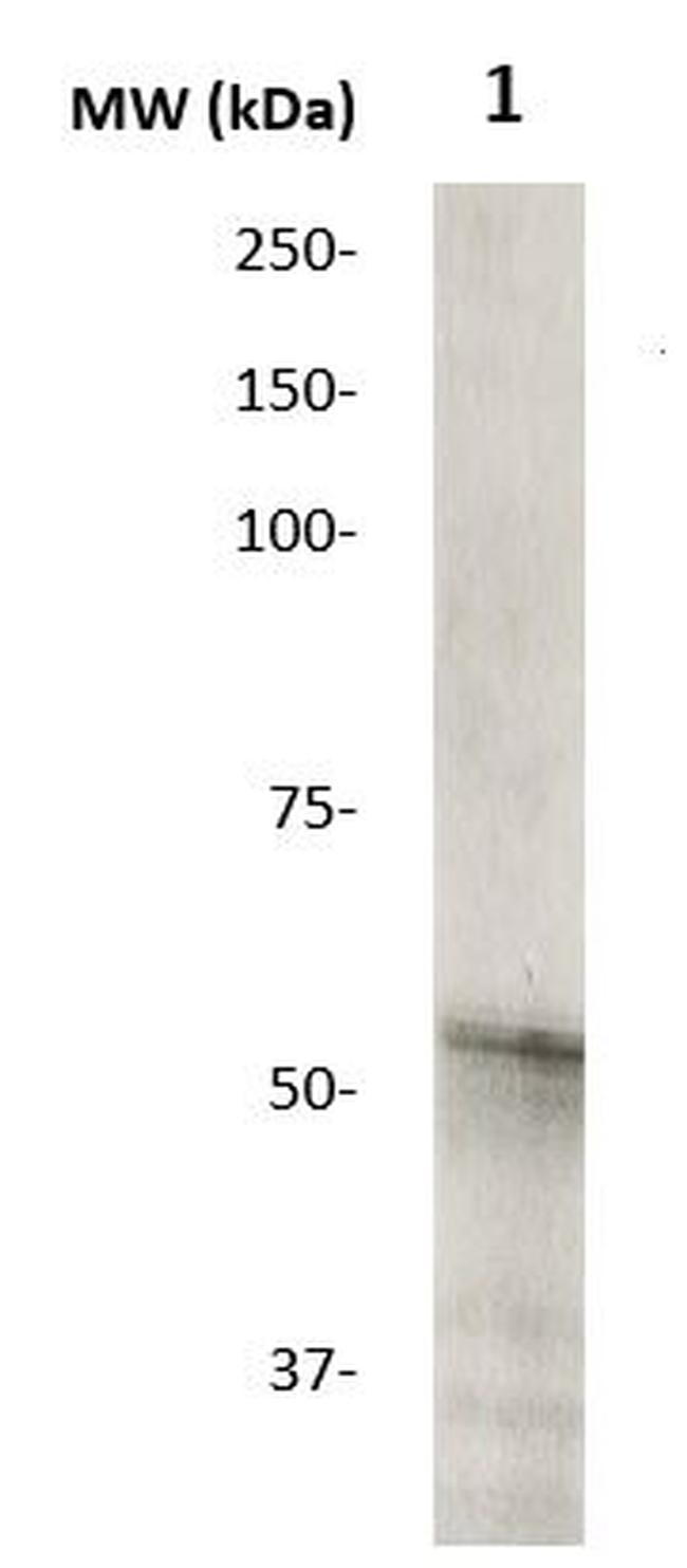 H5N1 (Influenza A virus) Antibody in Western Blot (WB)