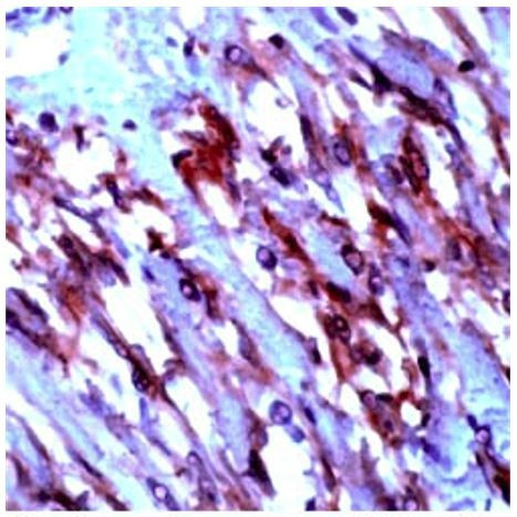 CD117/Kit/c-Kit Antibody in Immunohistochemistry (Paraffin) (IHC (P))