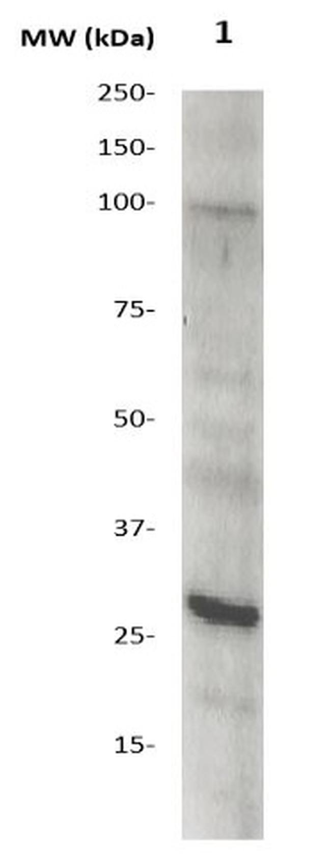 CRP Antibody in Western Blot (WB)