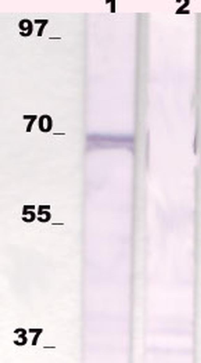 p70S6K Antibody in Western Blot (WB)