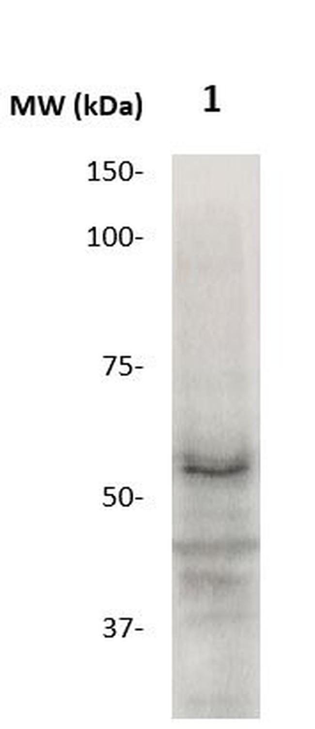 MMP-17 (MT4-MMP, MT-MMP-4) Antibody in Western Blot (WB)