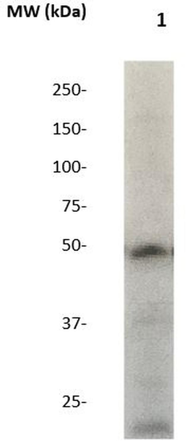 SOX6 Antibody in Western Blot (WB)