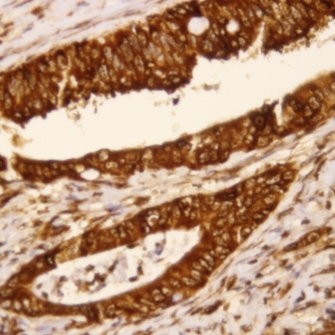 PDX-1 Antibody in Immunohistochemistry (Paraffin) (IHC (P))