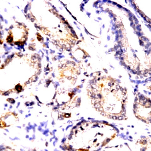 Phospho-CDC25b (Ser42) Antibody in Immunohistochemistry (Paraffin) (IHC (P))
