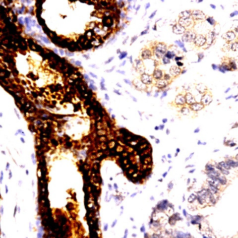 CDC25b Antibody in Immunohistochemistry (Paraffin) (IHC (P))