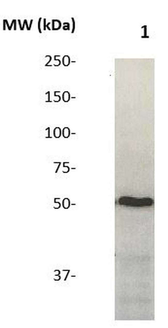 SPHK2 Antibody in Western Blot (WB)