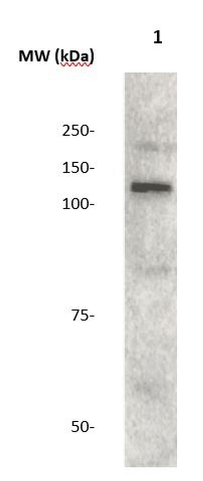 JAK2 Antibody in Western Blot (WB)