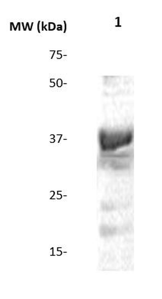 dNK (Deoxynucleoside Kinase) Antibody in Western Blot (WB)