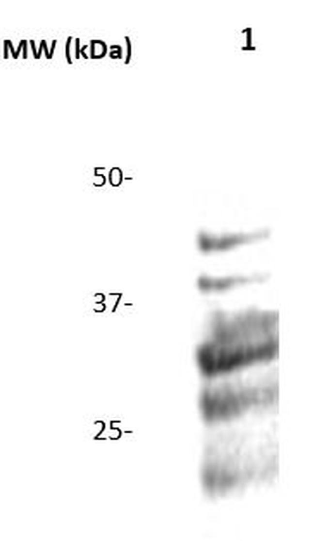TK1 (Thymidine Kinase) Antibody in Western Blot (WB)