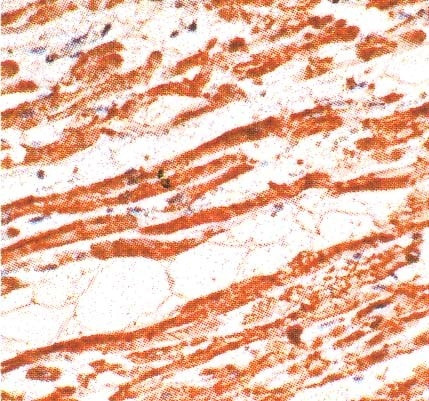 Troponin T Antibody in Immunohistochemistry (Paraffin) (IHC (P))