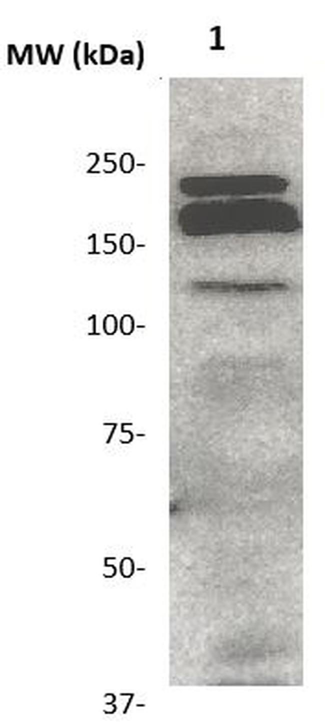 FLK-1 Antibody in Western Blot (WB)