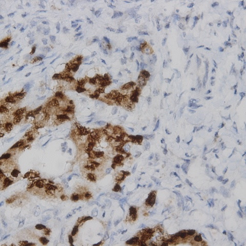 ER Antibody in Immunohistochemistry (Paraffin) (IHC (P))