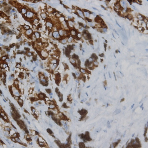 Phospho-CD136 (RON) (Tyr1238, Tyr1239) Antibody in Immunohistochemistry (Paraffin) (IHC (P))