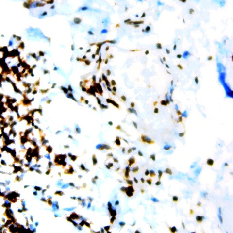 Phospho-CD136 (RON) (Tyr1238) Antibody in Immunohistochemistry (Paraffin) (IHC (P))