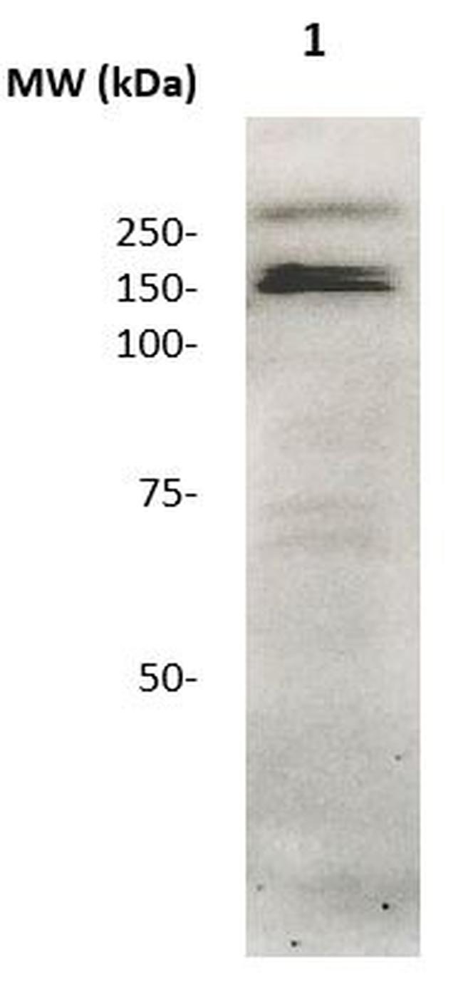 CD136 (RON) Antibody in Western Blot (WB)