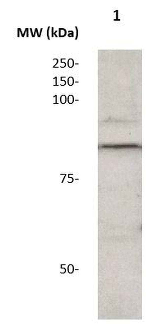 Phospho-Catenin-beta (Ser33) Antibody in Western Blot (WB)