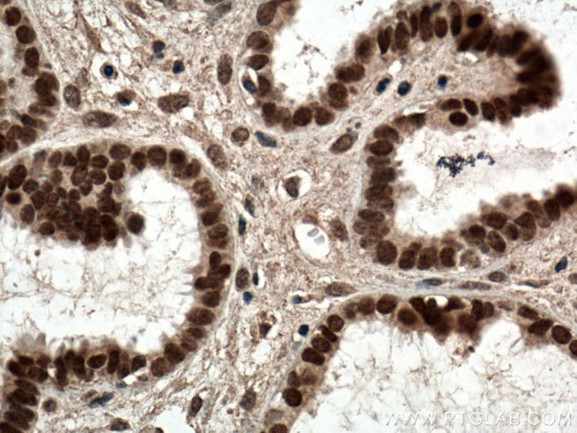 NR2F6 Antibody in Immunohistochemistry (Paraffin) (IHC (P))