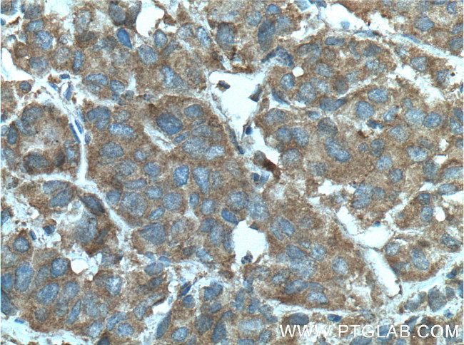 RABEP2 Antibody in Immunohistochemistry (Paraffin) (IHC (P))