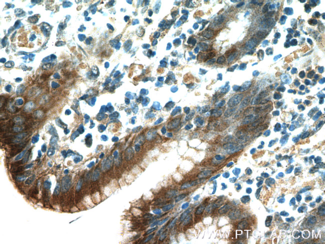 Gastrokine 1 Antibody in Immunohistochemistry (Paraffin) (IHC (P))