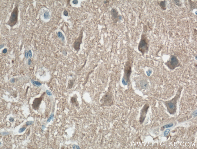KCNIP4 Antibody in Immunohistochemistry (Paraffin) (IHC (P))