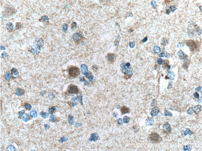 CUL4B Antibody in Immunohistochemistry (Paraffin) (IHC (P))
