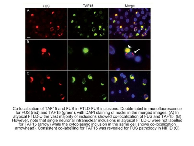FUS/TLS Antibody in Immunocytochemistry (ICC/IF)