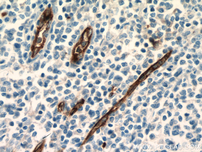 CD34 Antibody in Immunohistochemistry (Paraffin) (IHC (P))