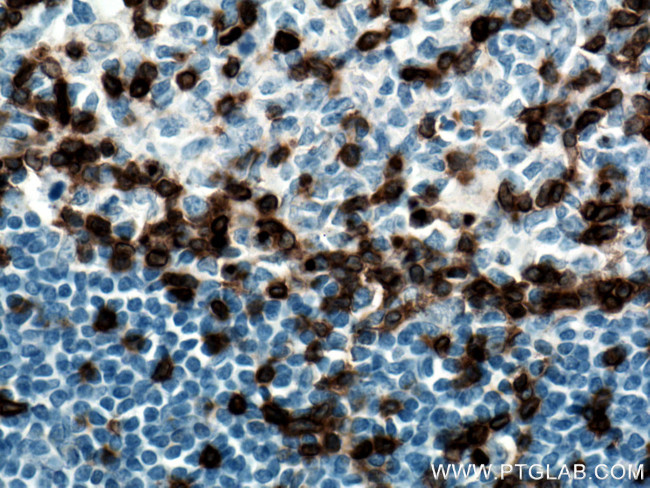 CD3 Antibody in Immunohistochemistry (Paraffin) (IHC (P))