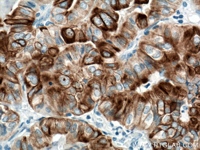 Cytokeratin 19 Antibody in Immunohistochemistry (Paraffin) (IHC (P))