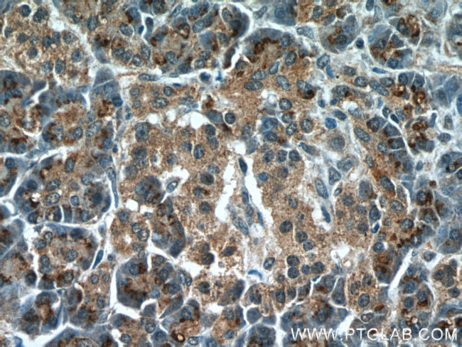 TMEM70 Antibody in Immunohistochemistry (Paraffin) (IHC (P))