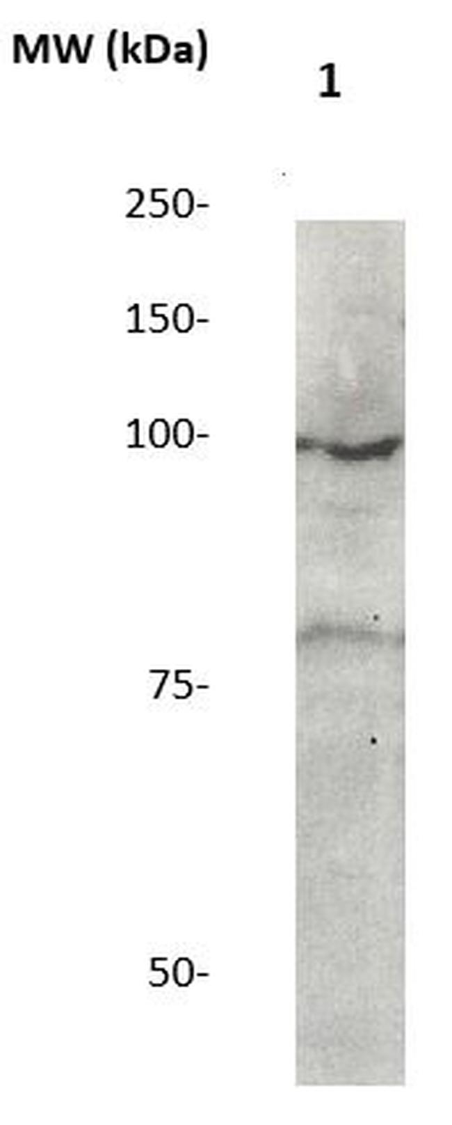 Catenin-Delta1 Antibody in Western Blot (WB)