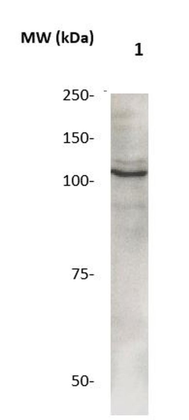 Phospho-Catenin-Delta1 (Tyr228) Antibody in Western Blot (WB)