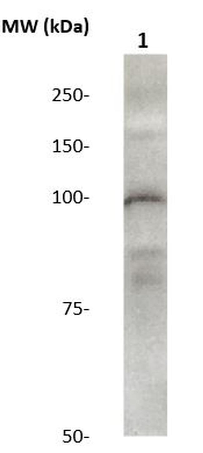 Phospho-Catenin-Delta1 (Tyr280) Antibody in Western Blot (WB)