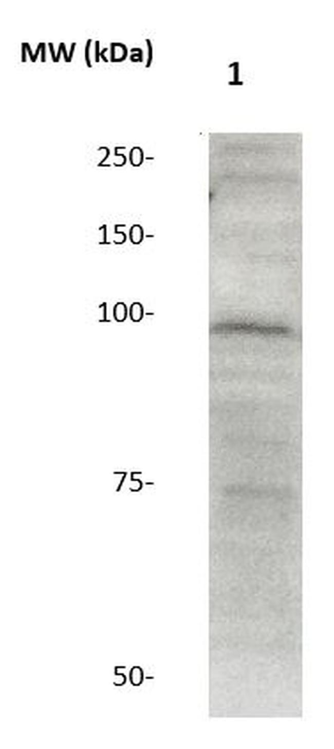 Catenin-Delta1 Antibody in Western Blot (WB)