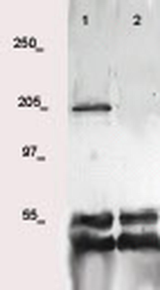 VEGFR-2 (CD309) Antibody in Western Blot (WB)