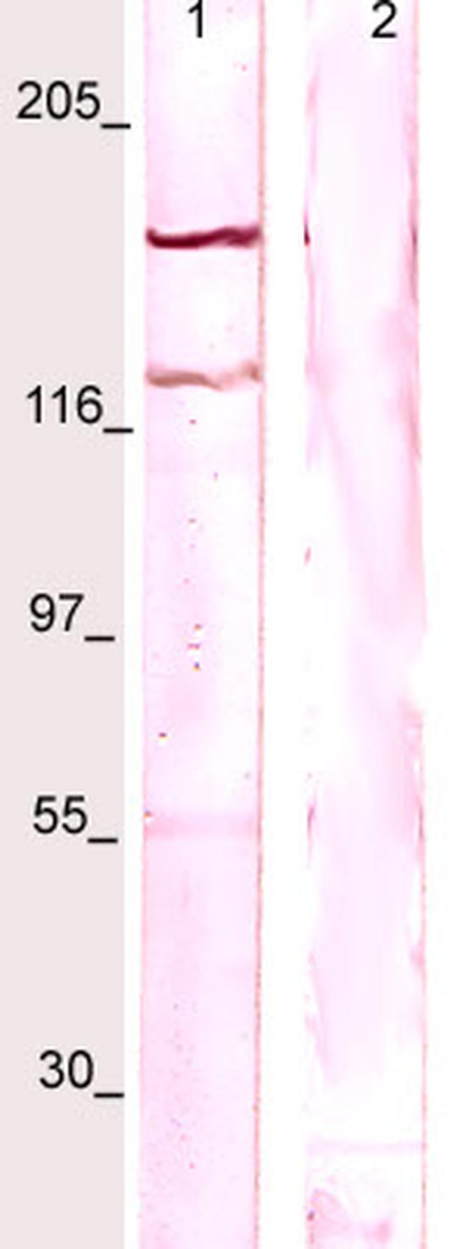 Phospho-CSF-1R (Tyr723) Antibody in Western Blot (WB)