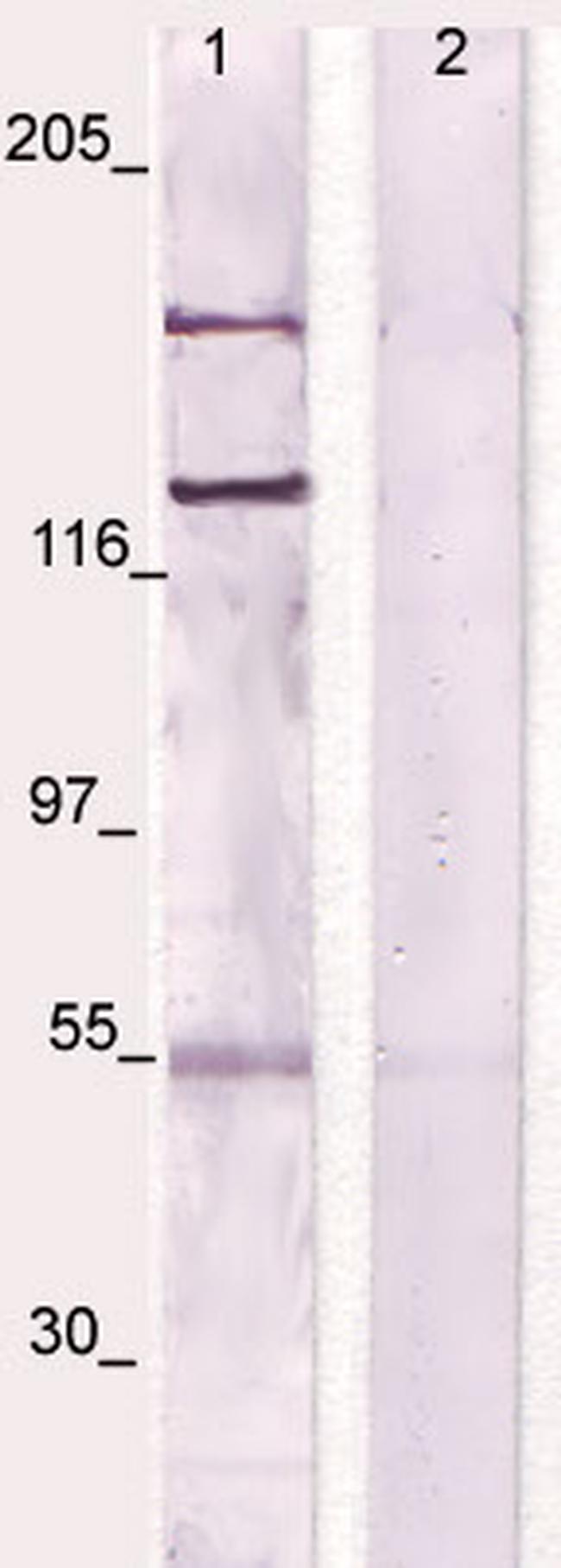 CSF-1R Antibody in Western Blot (WB)