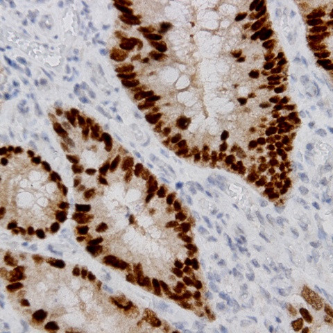 CDC2 Antibody in Immunohistochemistry (Paraffin) (IHC (P))