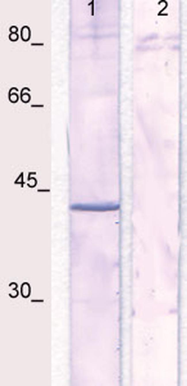 Phospho-IkBa (NFkB1A) (Ser32, Ser36) Antibody in Western Blot (WB)
