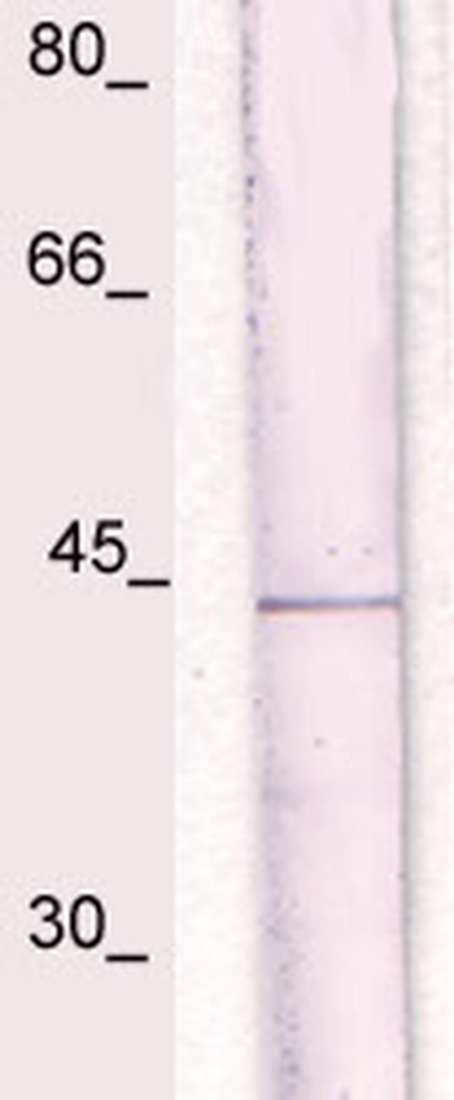 IkBa (NFKB1A) Antibody in Western Blot (WB)