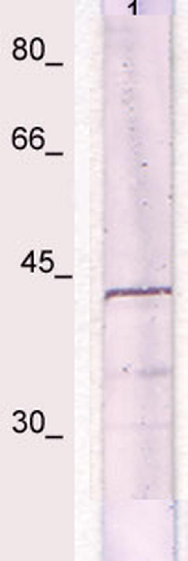 IkBa (NFKB1A) Antibody in Western Blot (WB)