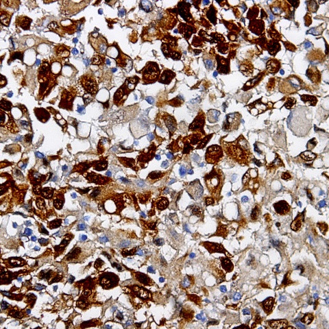 Phospho-Desmin (Thr76, Thr77) Antibody in Immunohistochemistry (Paraffin) (IHC (P))