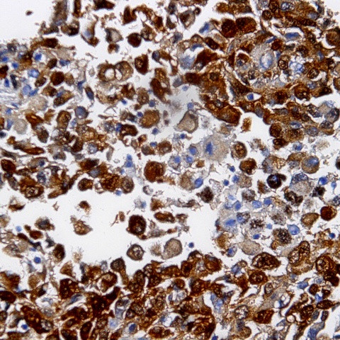 Desmin Antibody in Immunohistochemistry (Paraffin) (IHC (P))