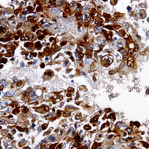 Desmin Antibody in Immunohistochemistry (Paraffin) (IHC (P))